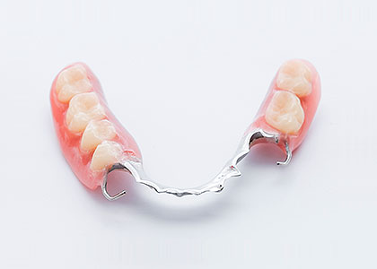 Partial dentures